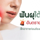 ผู้หญิงจับแก้มเพราะปวดฟันจากอาการฟันผุใต้ราก พร้อมข้อความ “ฟันผุใต้ราก อันตรายแค่ไหน เช็กอาการก่อนต้องถอนไม่รู้ตัว”