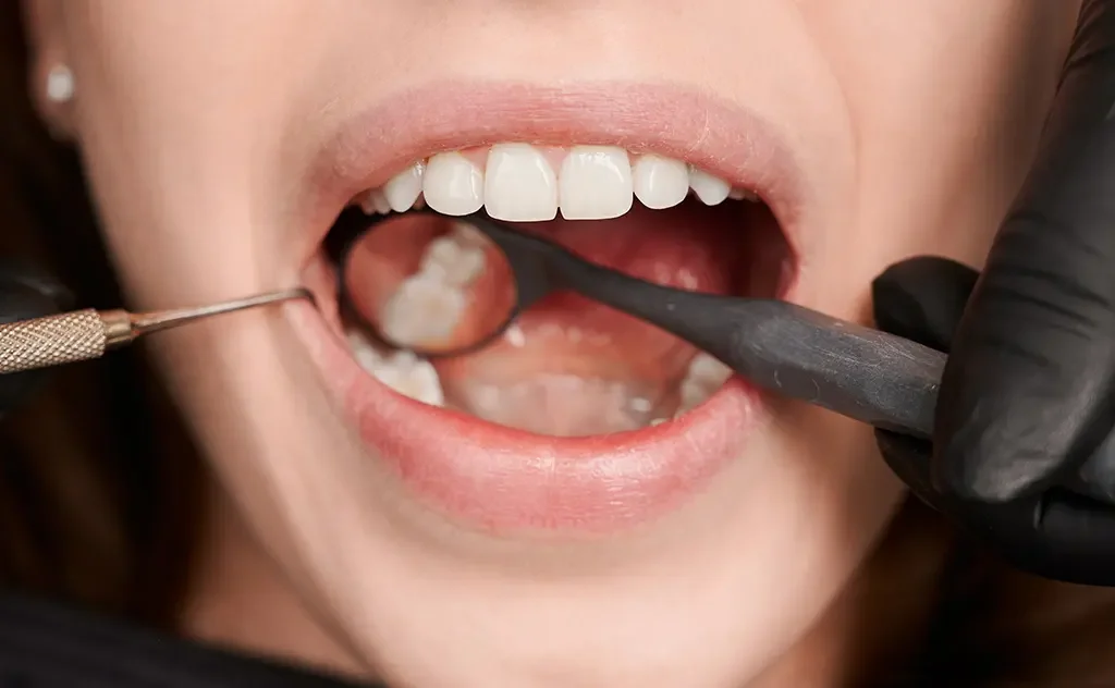 ทันตแพทย์ตรวจและรักษาฟันผุใต้รากให้ผู้ป่วย เพื่อป้องกันการติดเชื้อและการสูญเสียฟันถาวร