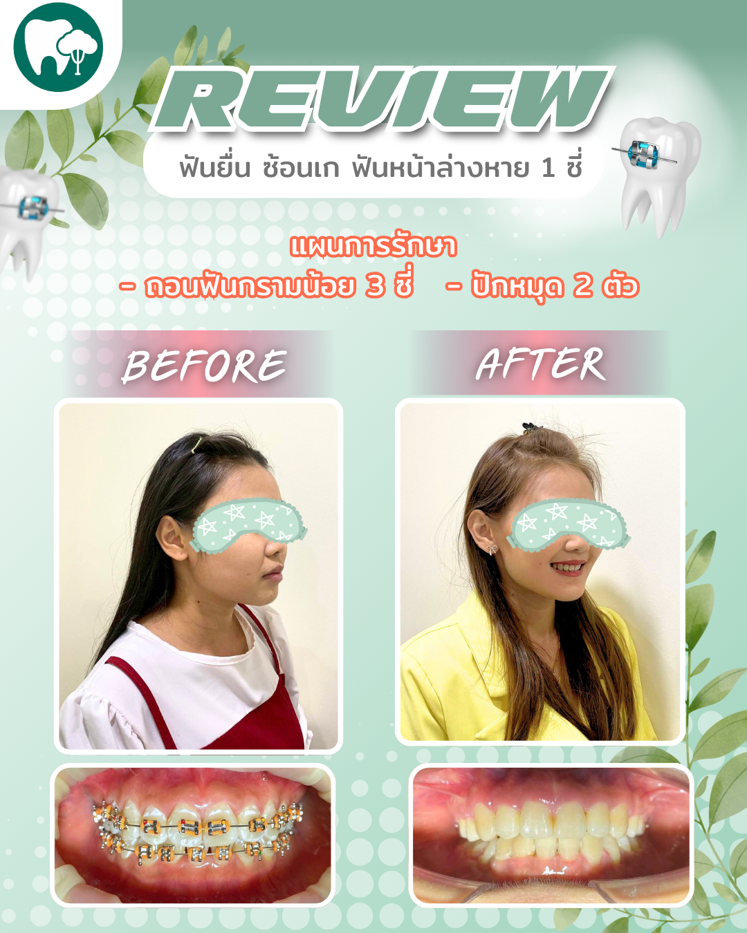 11_20250829_133817_0010