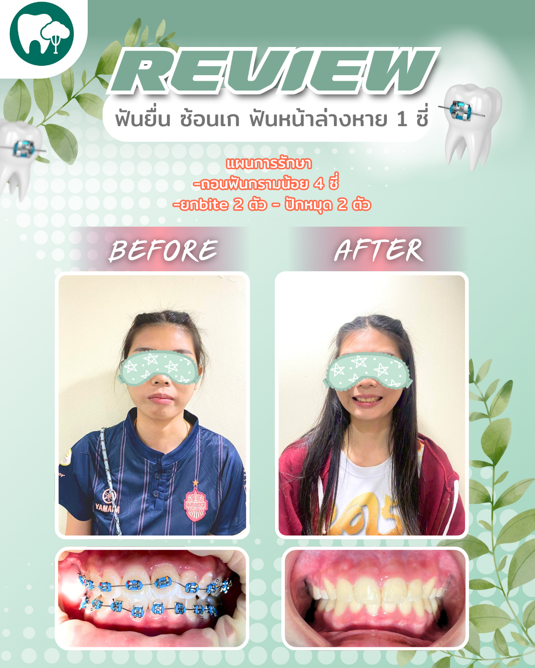 12_20250829_133818_0011