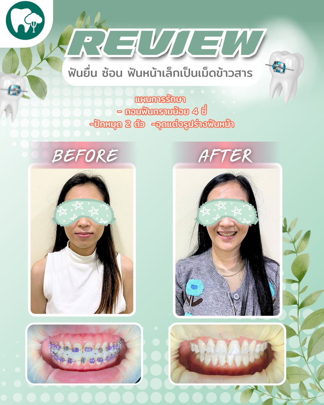 13_20250829_133818_0012