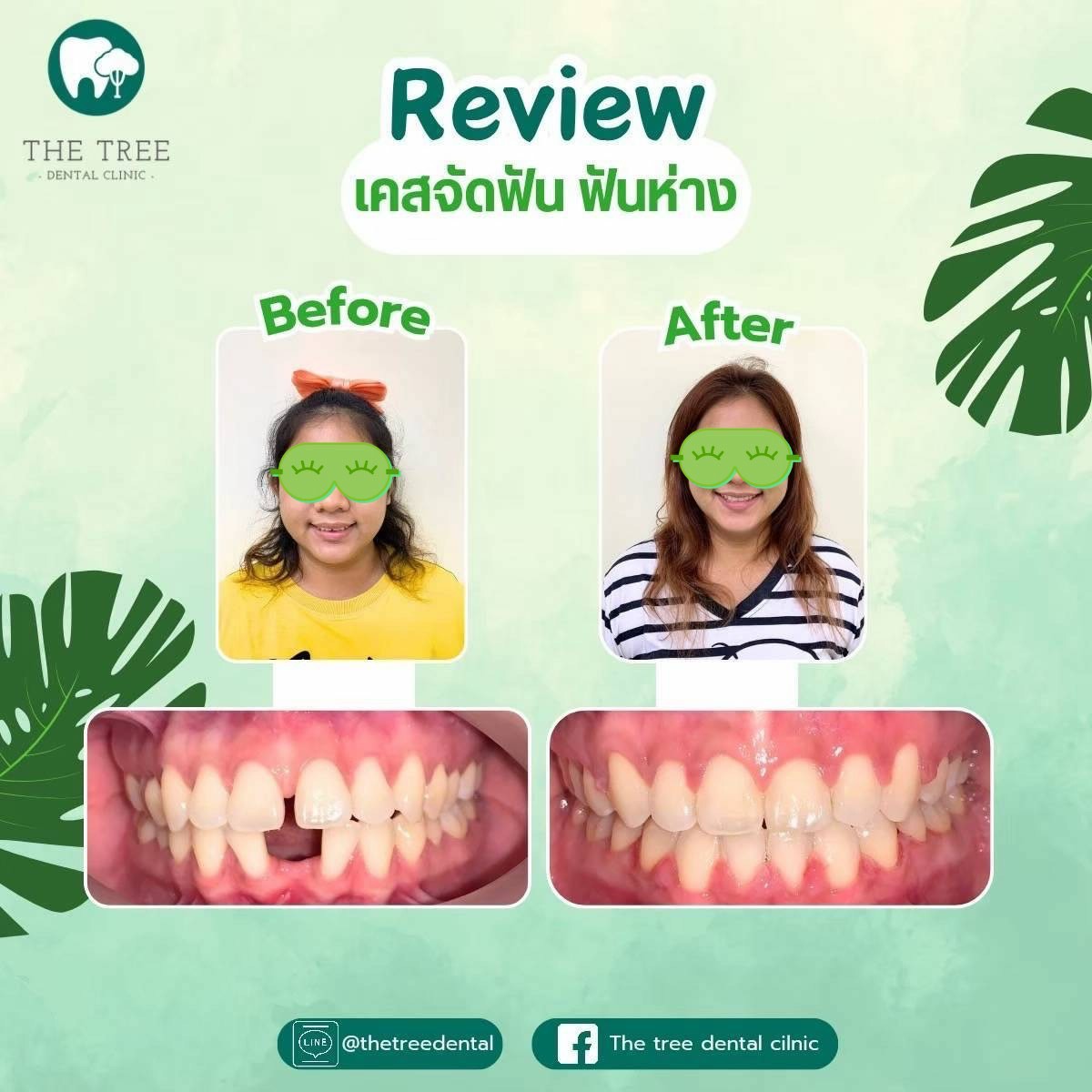 LINE_ALBUM_10072025_250718_10