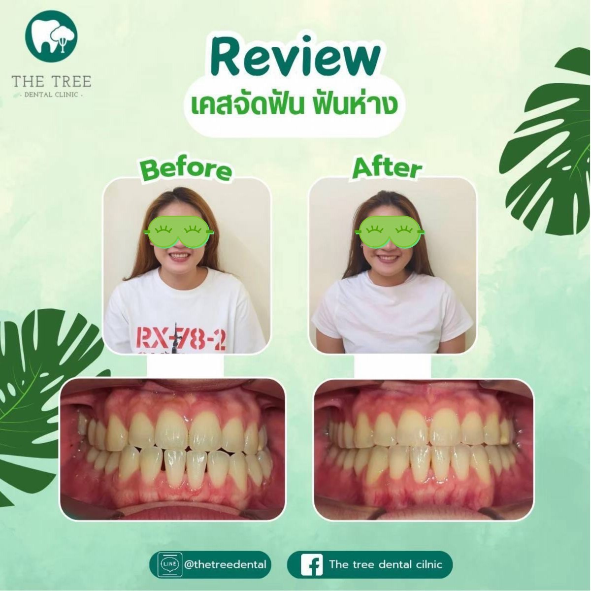 LINE_ALBUM_10072025_250718_11