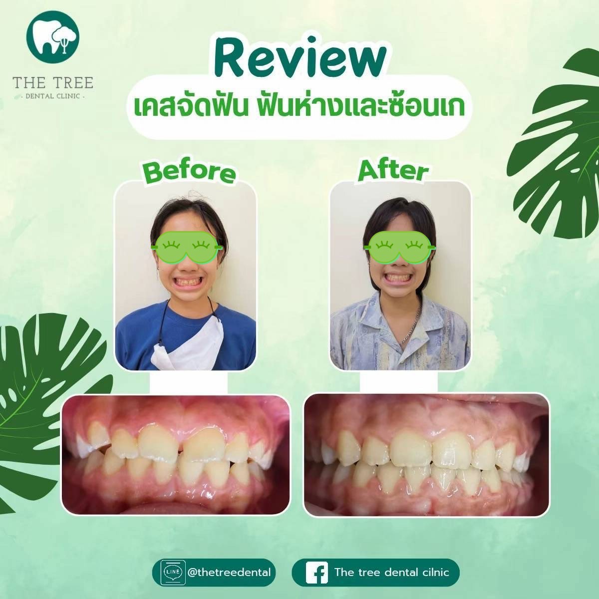 LINE_ALBUM_10072025_250718_12