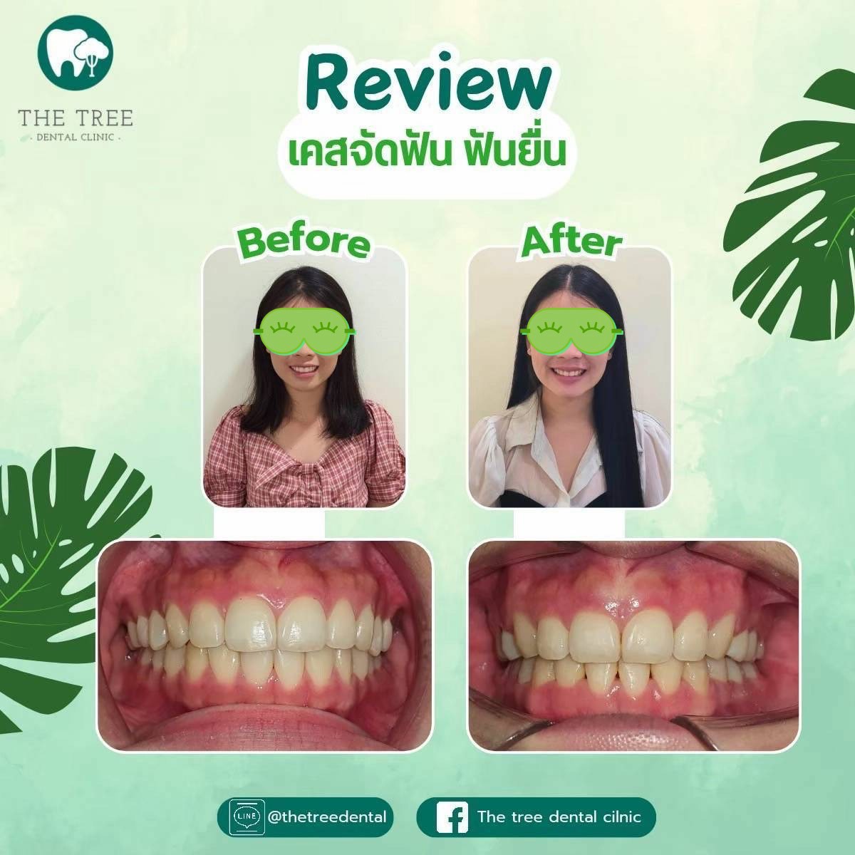 LINE_ALBUM_10072025_250718_3