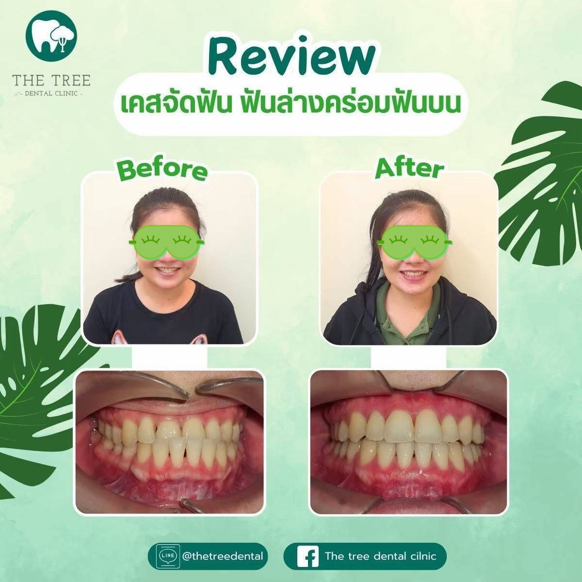 LINE_ALBUM_10072025_250718_6