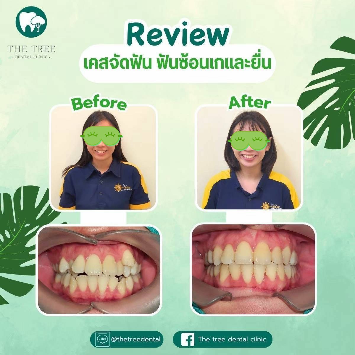 LINE_ALBUM_10072025_250718_7