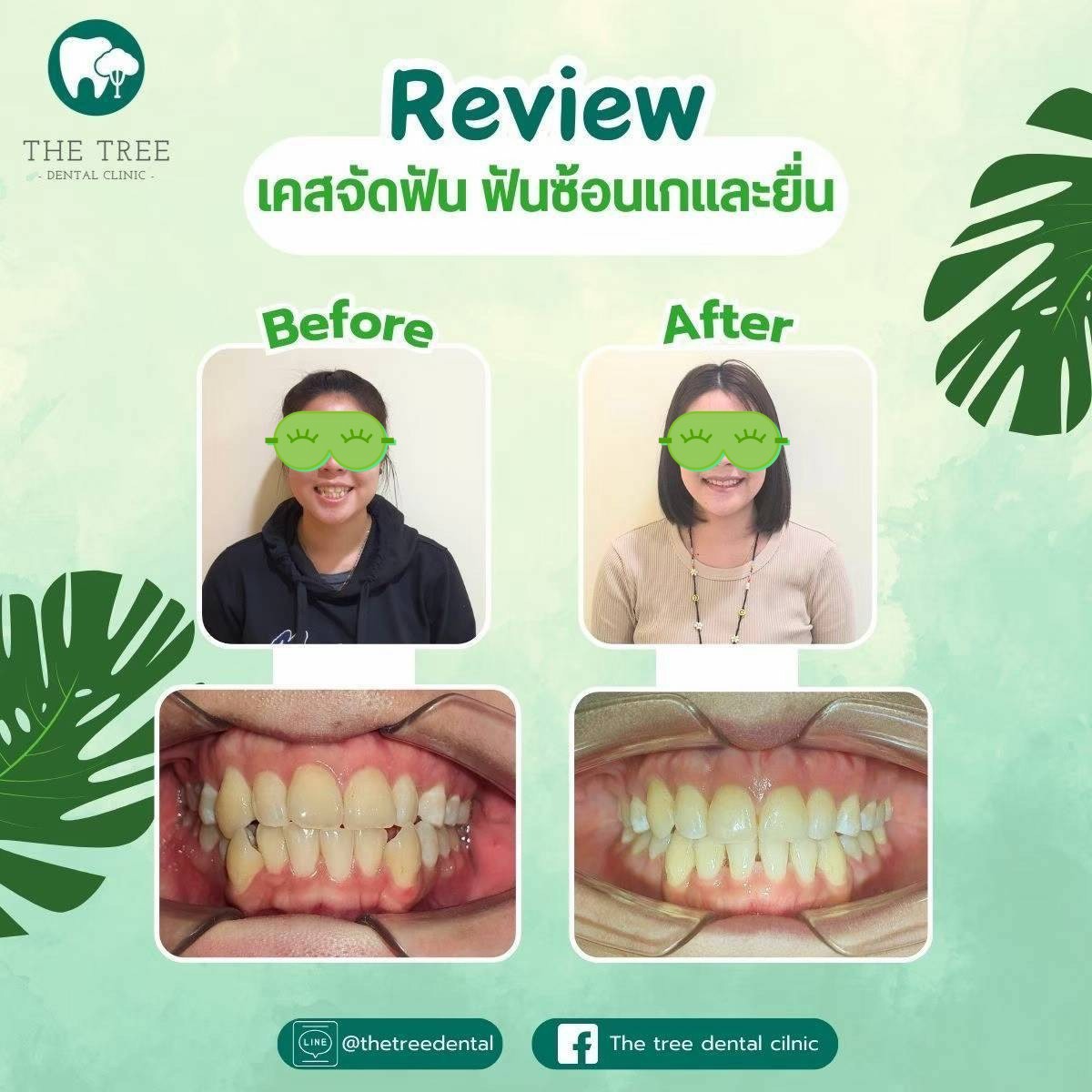 LINE_ALBUM_10072025_250718_8