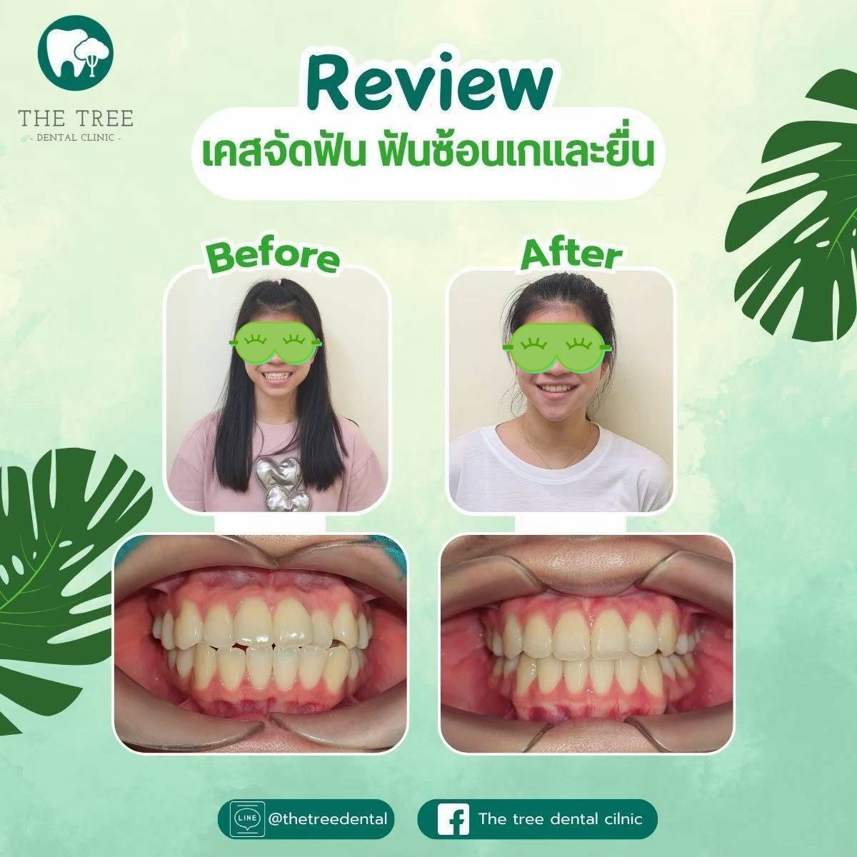 LINE_ALBUM_10072025_250718_9