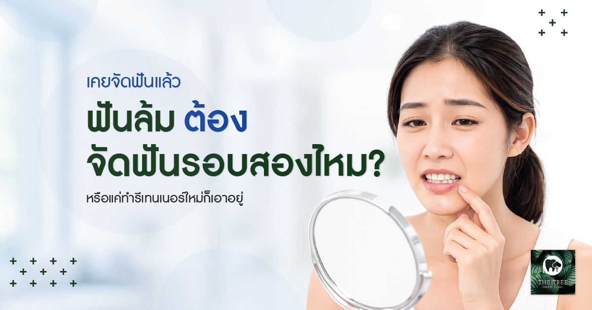 จัดฟันรอบสอง ฟันล้มหลังจัดฟัน ควรทำรีเทนเนอร์ใหม่