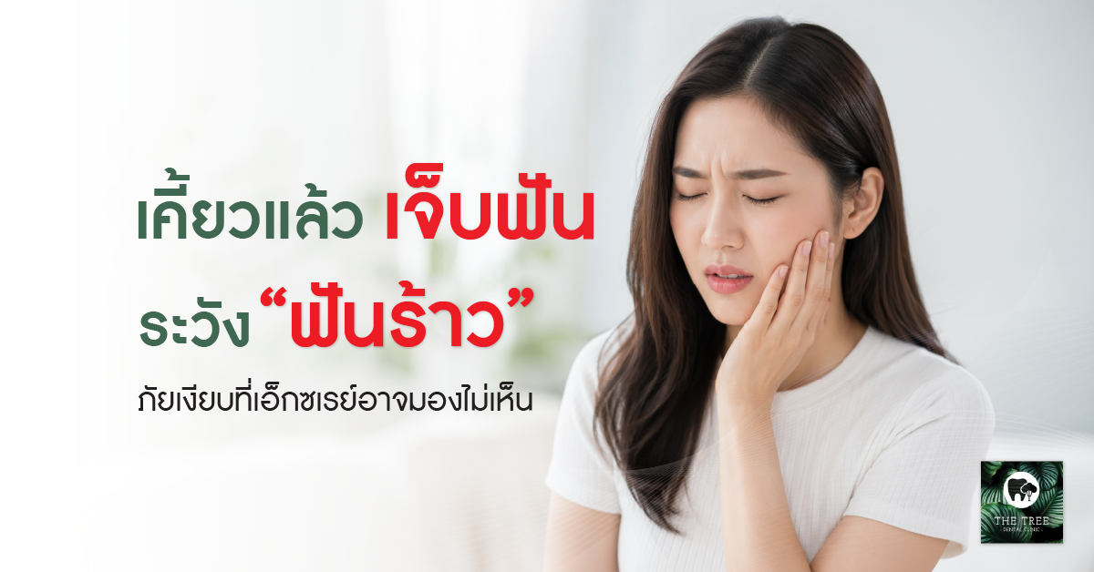 ผู้หญิงเอเชียมีอาการเคี้ยวแล้วเจ็บฟัน จับแก้มด้วยความเจ็บปวด สื่อถึงภาวะฟันร้าวที่เอ็กซเรย์อาจมองไม่เห็น